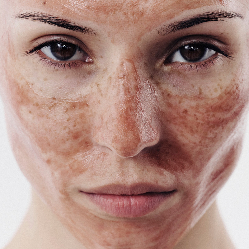 DR. EMI ARPA SKIN Pore Perfection Purifying Mask